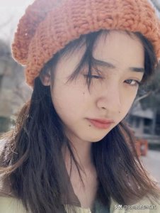 ​脸上这3处有“痣”的女人，气质越看越高级，可别轻易去点掉！