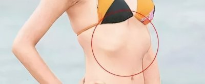 ​肋骨外翻身材性感？这可不是瘦的标志！7天轻松和它说拜拜
