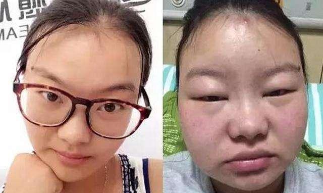 女人生完孩子对比照，看到最后一张，差点连亲妈都不认识了