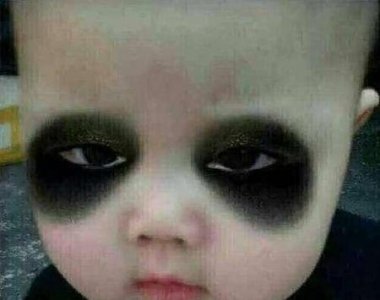 ​熬夜黑眼圈怎么去除 既简单又容易(黑眼圈怎么去除最有效的方法有哪些)