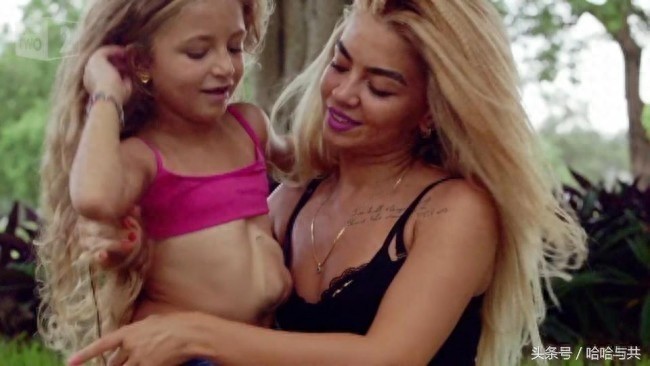 俄罗斯7岁女孩天生心脏长在外面，乐观开朗的她迅速走红网络