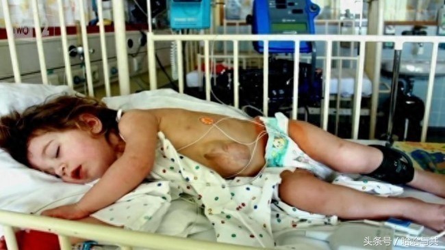 俄罗斯7岁女孩天生心脏长在外面，乐观开朗的她迅速走红网络