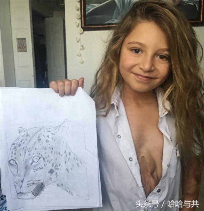 俄罗斯7岁女孩天生心脏长在外面，乐观开朗的她迅速走红网络